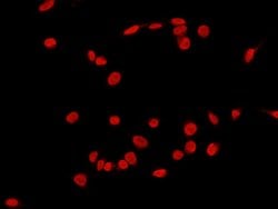 Invitrogen c-Fos Polyclonal Antibody 100 &mu;L; Unconjugated:Antibodies,