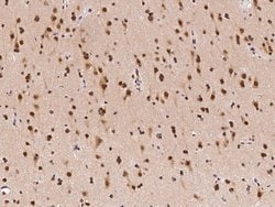 Invitrogen c-Fos Polyclonal Antibody 100 &mu;L; Unconjugated:Antibodies,