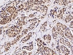 Invitrogen c-Fos Polyclonal Antibody 100 &mu;L; Unconjugated:Antibodies,