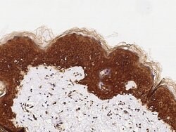 Invitrogen c-Fos Polyclonal Antibody 100 &mu;L; Unconjugated:Antibodies,