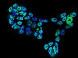 Invitrogen FOXK1 Polyclonal Antibody 100 &mu;L; Unconjugated:Antibodies,