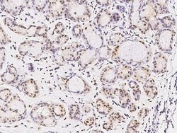 Invitrogen FOXK1 Polyclonal Antibody 100 &mu;L; Unconjugated:Antibodies,