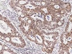 Invitrogen FOXK1 Polyclonal Antibody 100 &mu;L; Unconjugated:Antibodies,