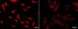 Invitrogen GLI1 Polyclonal Antibody 100 &mu;L; Unconjugated:Antibodies,