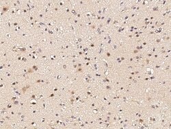 Invitrogen GLI1 Polyclonal Antibody 100 &mu;L; Unconjugated:Antibodies,