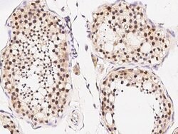 Invitrogen GLI1 Polyclonal Antibody 100 &mu;L; Unconjugated:Antibodies,