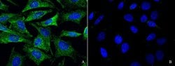 Invitrogen GluR6 Polyclonal Antibody 100 &mu;L; Unconjugated:Antibodies,