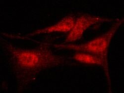 Invitrogen HDAC4 Polyclonal Antibody 100 &mu;L; Unconjugated:Antibodies,