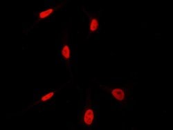 Invitrogen HEXIM1 Polyclonal Antibody 100 &mu;L; Unconjugated:Antibodies,