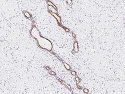 Invitrogen HIPK1 Polyclonal Antibody 100 &mu;L; Unconjugated:Antibodies,