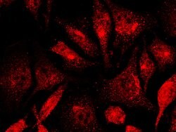 Invitrogen JMJD1A Polyclonal Antibody 100 &mu;L; Unconjugated:Antibodies,