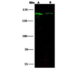 Invitrogen JMJD1A Polyclonal Antibody 100 &mu;L; Unconjugated:Antibodies,