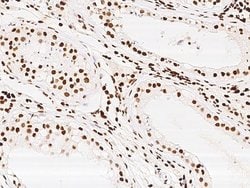 Invitrogen KLF7 Polyclonal Antibody 100 &mu;L; Unconjugated:Antibodies,