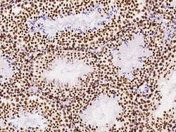 Invitrogen KLF7 Polyclonal Antibody 100 &mu;L; Unconjugated:Antibodies,