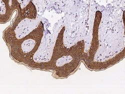 Invitrogen KRT79 Polyclonal Antibody 100 &mu;L; Unconjugated:Antibodies,