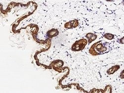 Invitrogen KRT79 Polyclonal Antibody 100 &mu;L; Unconjugated:Antibodies,
