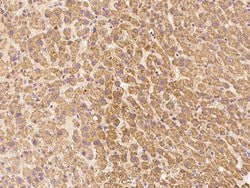 Invitrogen LIN52 Polyclonal Antibody 100 &mu;L | Buy Online | Invitrogen&trade; | Fisher Scientific