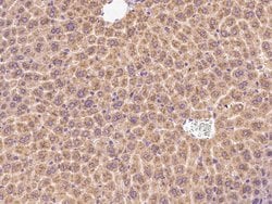 Invitrogen LIN52 Polyclonal Antibody 100 &mu;L | Buy Online | Invitrogen&trade; | Fisher Scientific