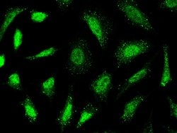 Invitrogen LRP1 Polyclonal Antibody 100 &mu;L; Unconjugated:Antibodies,