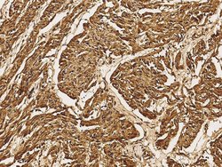 MEK5 Polyclonal Antibody 100 &mu;L | Buy Online | Thermo Scientific | Fisher Scientific