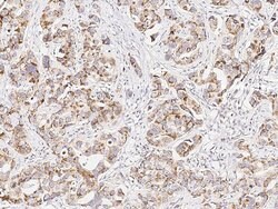 Invitrogen p38 MAPK beta Polyclonal Antibody 100 &mu;L; Unconjugated:Antibodies,