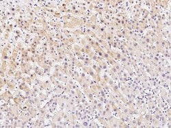 Invitrogen p38 MAPK beta Polyclonal Antibody 100 &mu;L; Unconjugated:Antibodies,
