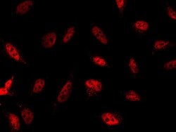 Invitrogen JNK1 Polyclonal Antibody 100 &mu;L; Unconjugated:Antikroppar