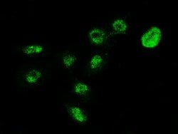 MECP2 Polyclonal Antibody:Antibodies, Polyclonal