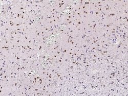 MECP2 Polyclonal Antibody:Antibodies, Polyclonal