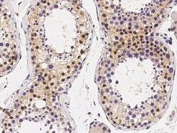 MECP2 Polyclonal Antibody:Antibodies, Polyclonal