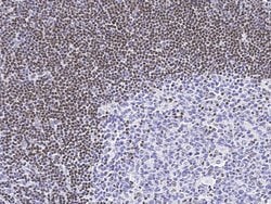MECP2 Polyclonal Antibody:Antibodies, Polyclonal