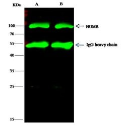 Invitrogen NUMB Polyclonal Antibody 100 &mu;L | Buy Online | Invitrogen&trade; | Fisher Scientific