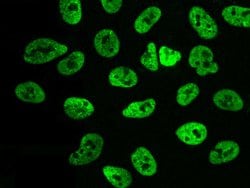 Invitrogen PAX2 Polyclonal Antibody 100 &mu;L; Unconjugated:Antibodies,