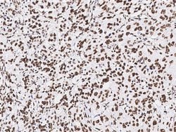 Invitrogen PAX2 Polyclonal Antibody 100 &mu;L; Unconjugated:Antibodies,