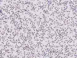 Invitrogen PAX2 Polyclonal Antibody 100 &mu;L; Unconjugated:Antibodies,