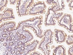 Invitrogen PIK3R2 Polyclonal Antibody 100 &mu;L | Buy Online | Invitrogen&trade; | Fisher Scientific