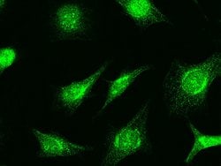 RAD51 Polyclonal Antibody:Antibodies, Polyclonal