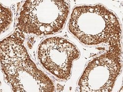 RAD51 Polyclonal Antibody:Antibodies, Polyclonal