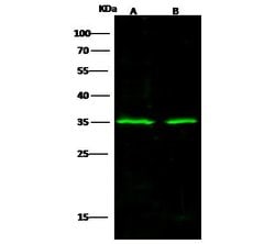 Invitrogen S6 Polyclonal Antibody 100 &mu;L; Unconjugated:Antibodies, Polyclonal