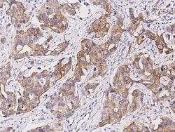 Invitrogen SENP8 Polyclonal Antibody 100 &mu;L; Unconjugated:Antibodies,