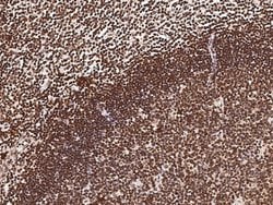Invitrogen DP1 Polyclonal Antibody 100 &mu;L; Unconjugated:Antibodies,