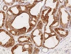 Invitrogen TNRC6A Polyclonal Antibody 100 &mu;L; Unconjugated:Antibodies,