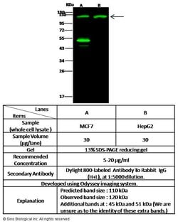 Invitrogen TSC22D1 Polyclonal Antibody 100 &mu;L; Unconjugated:Antibodies,
