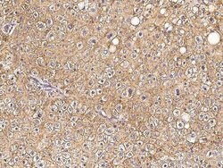 Invitrogen alpha Tubulin Polyclonal Antibody 100 &mu;L; Unconjugated:Antikroppar