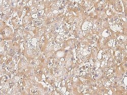 Invitrogen UBE4B Polyclonal Antibody 100 &mu;L; Unconjugated:Antibodies,