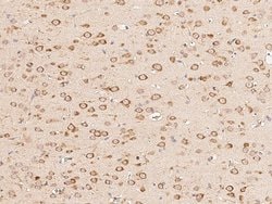 Invitrogen BRE Polyclonal Antibody 100 &mu;L; Unconjugated:Antibodies,