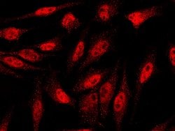 Invitrogen CAND1 Polyclonal Antibody 100 &mu;L; Unconjugated:Antibodies,