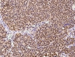 Invitrogen CAND1 Polyclonal Antibody 100 &mu;L; Unconjugated:Antibodies,