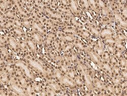 Invitrogen CAND1 Polyclonal Antibody 100 &mu;L; Unconjugated:Antibodies,