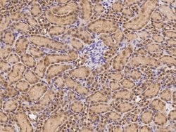 Invitrogen CAND1 Polyclonal Antibody 100 &mu;L; Unconjugated:Antibodies,